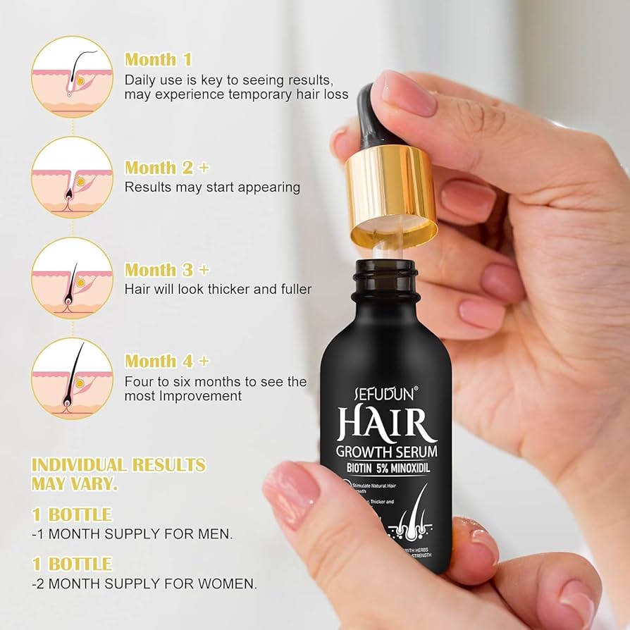5% Minoxidil Hair Growth Serum for Men and Women, Hair Growth Oil Hair Regrowth Treatment for Scalp Hair Loss Hair Thinning,Stronger, Hair Regrowth Serum for Thicker Longer Fuller Hair A
