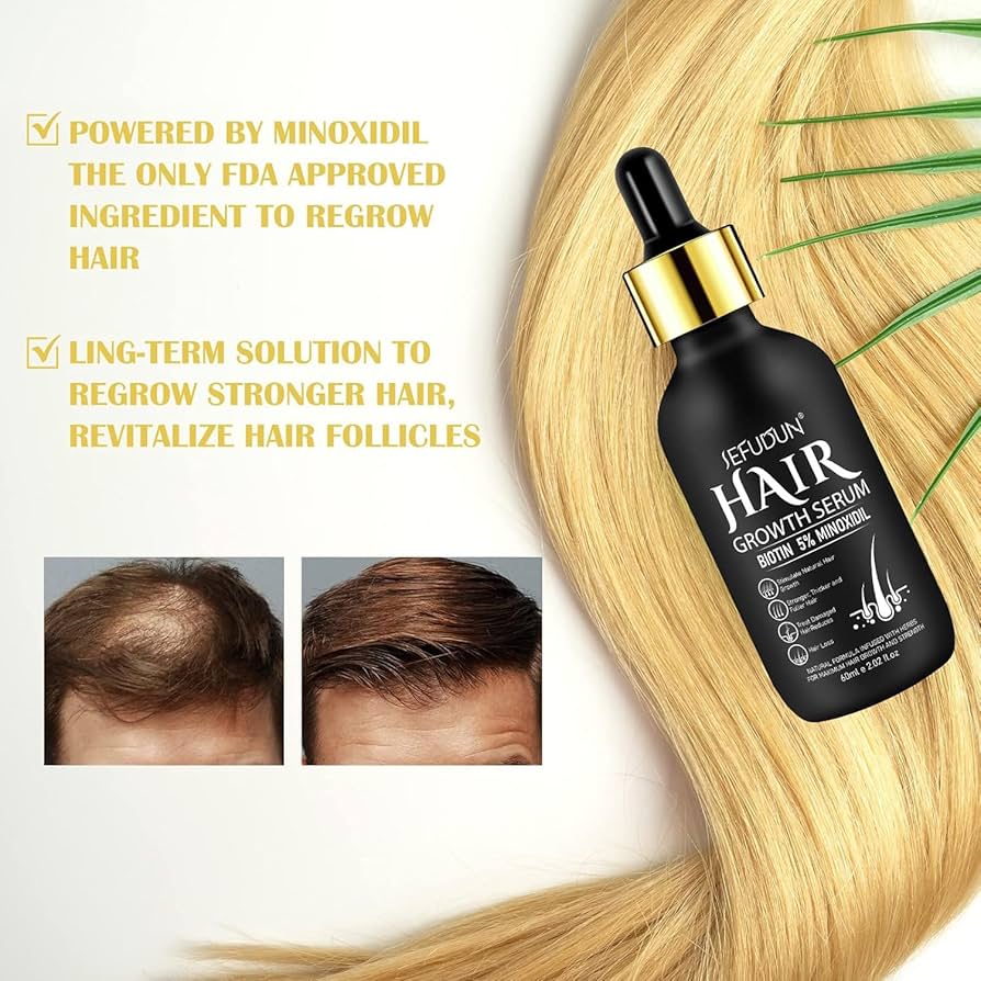 5% Minoxidil Hair Growth Serum for Men and Women, Hair Growth Oil Hair Regrowth Treatment for Scalp Hair Loss Hair Thinning,Stronger, Hair Regrowth Serum for Thicker Longer Fuller Hair A