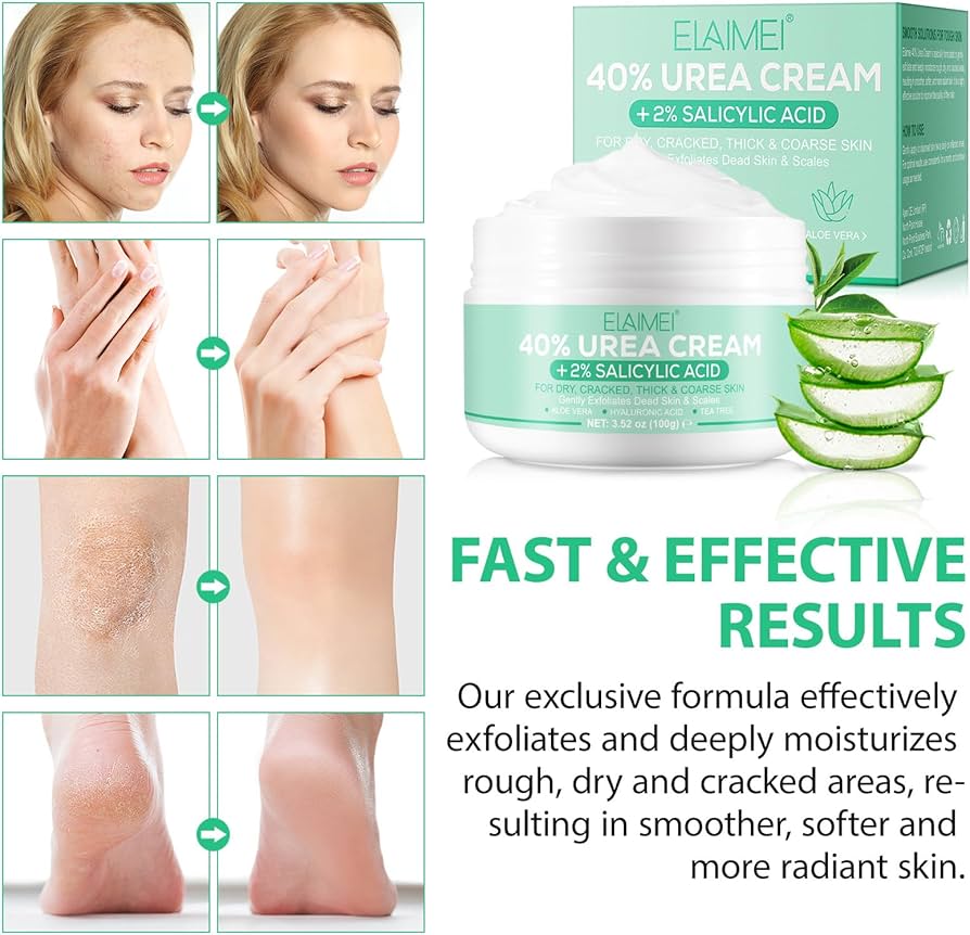 Urea Cream, Urea Foot Cream, Urea Cream 40% with 2% Salicylic Acid, Urea Foot Cream Plus Deep Moisturising for Dry, Cracked Feet, Heels and Hands, 100 g