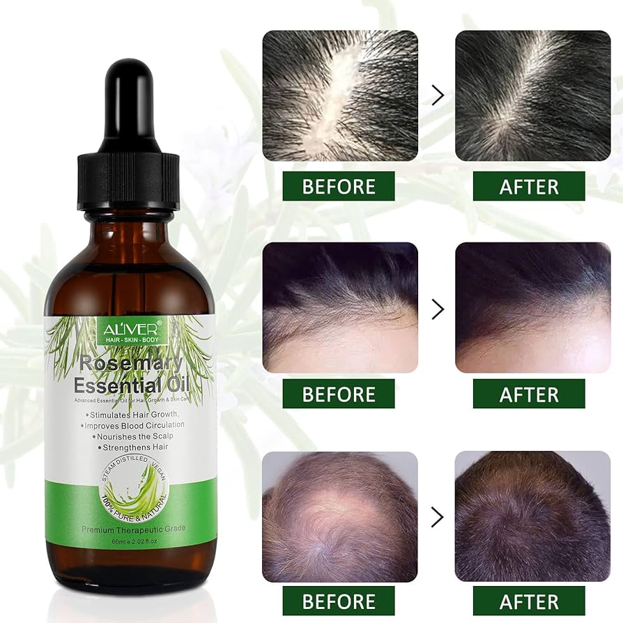 Rosemary Oil for Hair Growth, Rosemary Essential Oil for Stimulate Hair Growth, Massage Scalp and Boost Blood Circulation, Natrual Hair Oil for Aromatherapy & Diffuser for Women, Men - 60ML