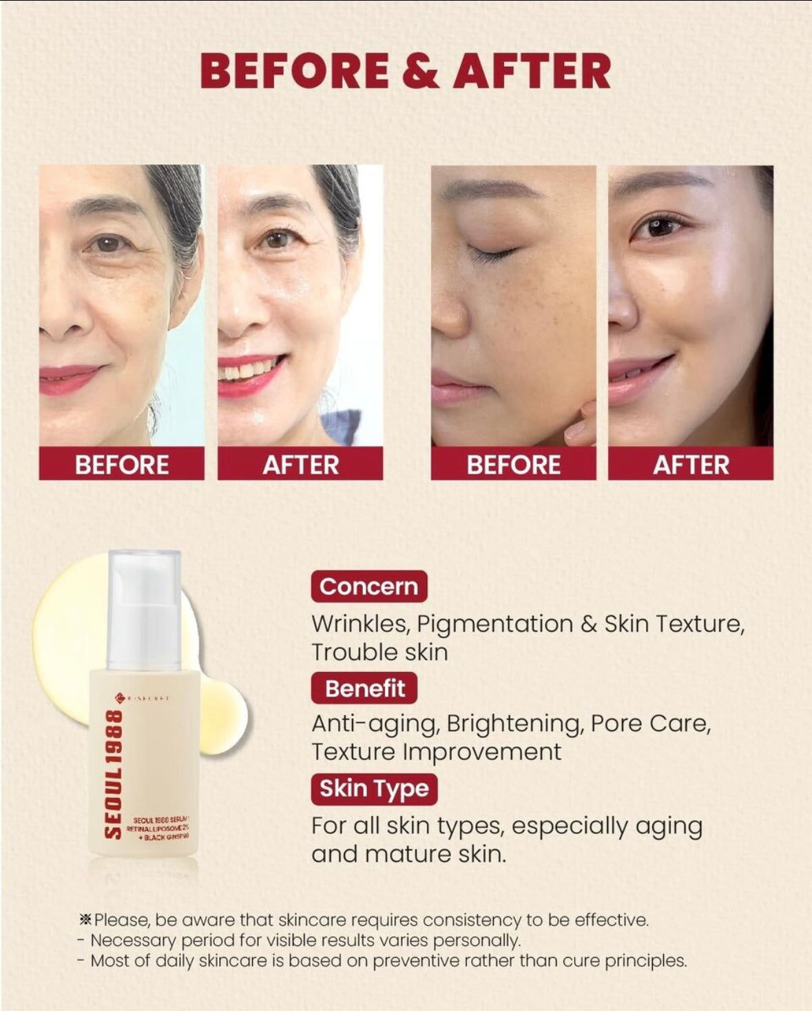 Seoul 1988 Retinol